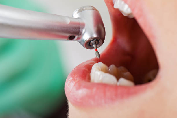 Best Emergency Dentist for Lost Fillings or Crowns in Eagle Lake, TX